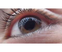 Does What You Eat Impact On Cataracts Know With Adelaide Eye Surgeons