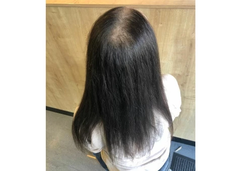 Hair Loss Treatment Clinic - 2/6