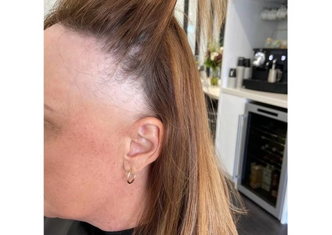 Hair Loss Treatment Clinic - 3/6