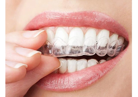 Teeth Whitening Dentist | Admire Dentistry