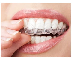 Teeth Whitening Dentist | Admire Dentistry