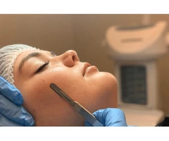 Enlarged Skin Pores Treatment Coogee