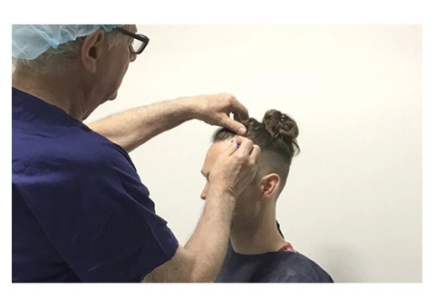 Low Fue Hair Transplant Clinic Cost - 5/7